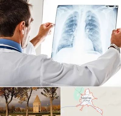دکتر متخصص ریه در تویسرکان