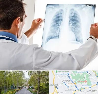 دکتر متخصص ریه در قدوسی غربی شیراز