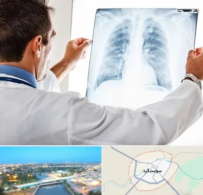 دکتر متخصص ریه در سوسنگرد