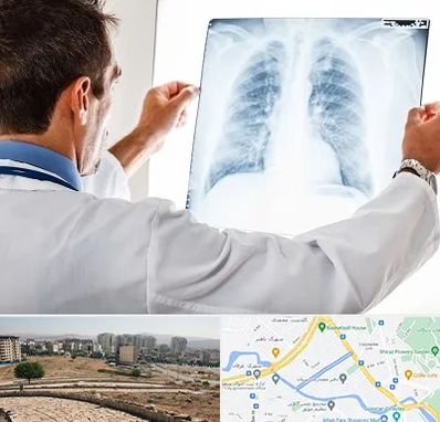 دکتر متخصص ریه در کوی وحدت شیراز