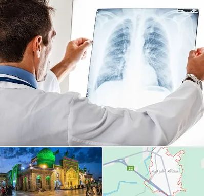 دکتر متخصص ریه در آستانه اشرفیه