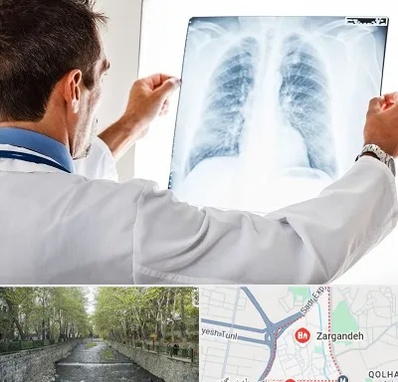 دکتر متخصص ریه در زرگنده