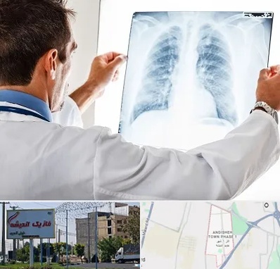 دکتر متخصص ریه در فاز یک اندیشه