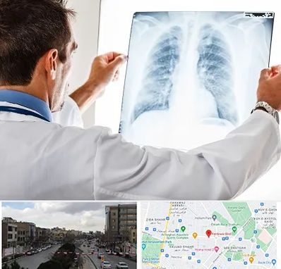 دکتر متخصص ریه در بلوار فردوسی مشهد