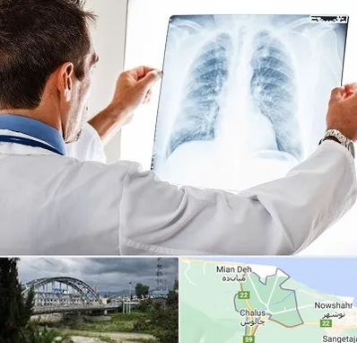 دکتر متخصص ریه در چالوس