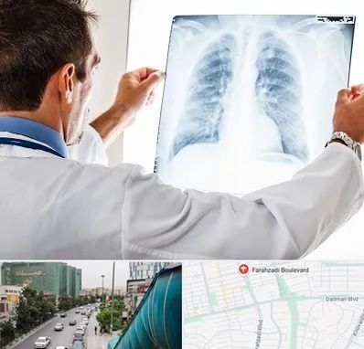 دکتر متخصص ریه در بلوار فرحزادی