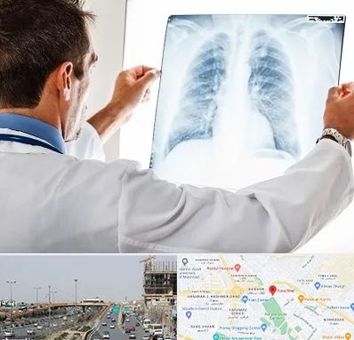 دکتر متخصص ریه در بلوار توس مشهد