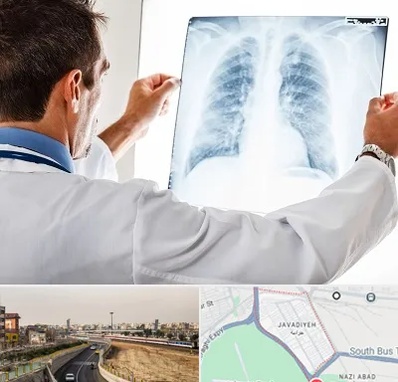 دکتر متخصص ریه در جوادیه