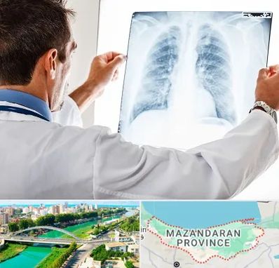 دکتر متخصص ریه در مازندران