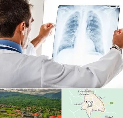 دکتر متخصص ریه در آمل