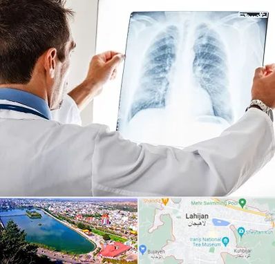 دکتر متخصص ریه در لاهیجان