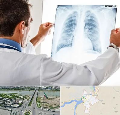 دکتر متخصص ریه در میاندوآب