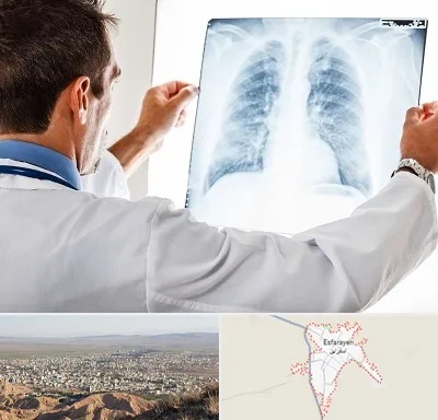 دکتر متخصص ریه در اسفراین