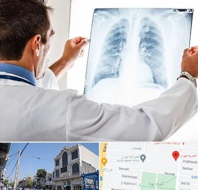 دکتر متخصص ریه در افسریه 