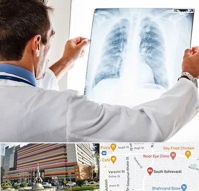 دکتر متخصص ریه در سهروردی 