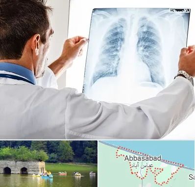 دکتر متخصص ریه در عباس آباد