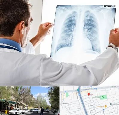 دکتر متخصص ریه در کوی فیروز تبریز