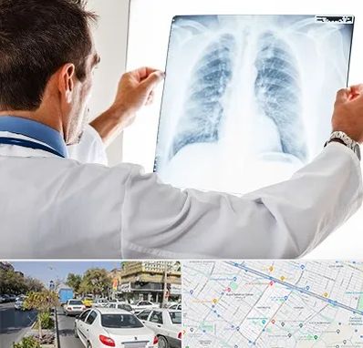 دکتر متخصص ریه در مفتح مشهد