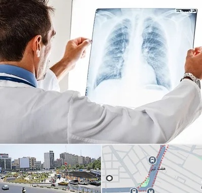 دکتر متخصص ریه در هفت تیر