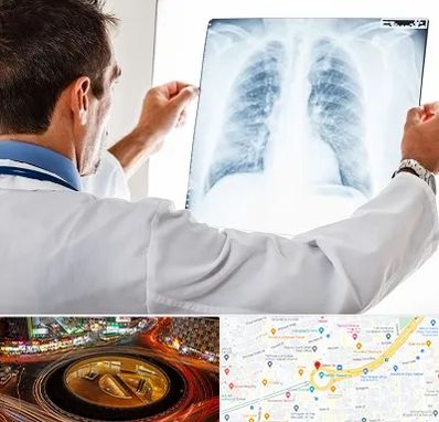 دکتر متخصص ریه در میدان ولیعصر 