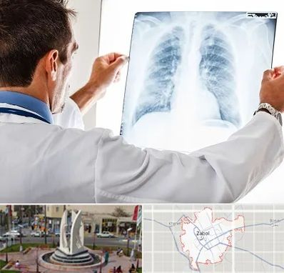 دکتر متخصص ریه در زابل