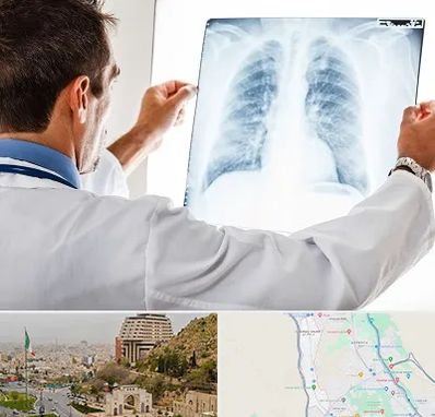 دکتر متخصص ریه در فرهنگ شهر شیراز