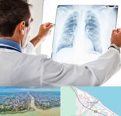 دکتر متخصص ریه در تنکابن