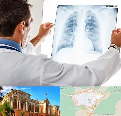 دکتر متخصص ریه در خوی