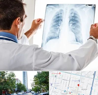 دکتر متخصص ریه در امامت مشهد