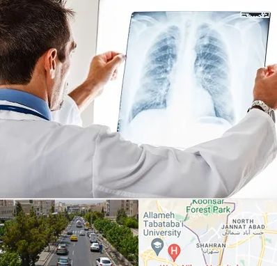 دکتر متخصص ریه در شهران 