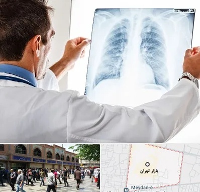 دکتر متخصص ریه در بازار تهران