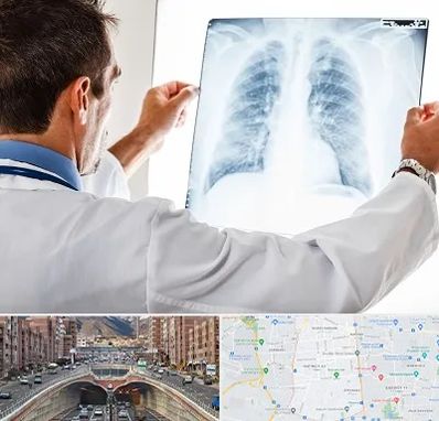 دکتر متخصص ریه در منطقه 10 تهران 