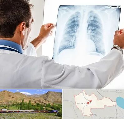 دکتر متخصص ریه در خاش