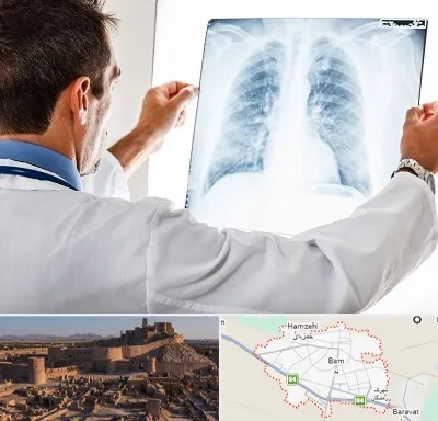 دکتر متخصص ریه در بم