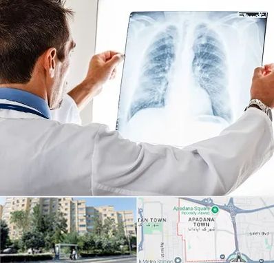 دکتر متخصص ریه در آپادانا
