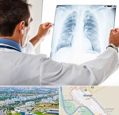 دکتر متخصص ریه در آبادان