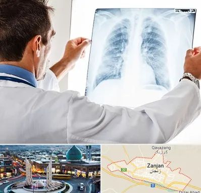 دکتر متخصص ریه در زنجان