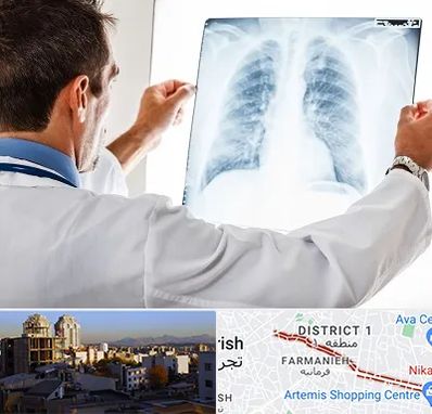 دکتر متخصص ریه در فرمانیه 