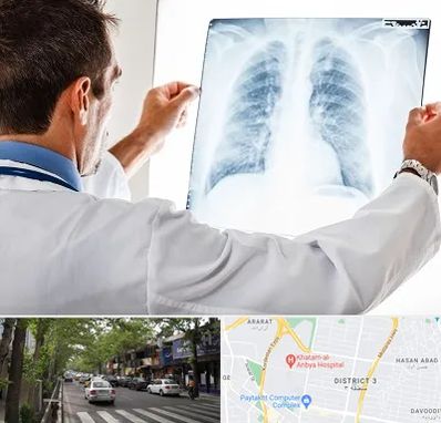دکتر متخصص ریه در ظفر 