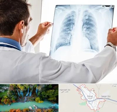 دکتر متخصص ریه در دورود