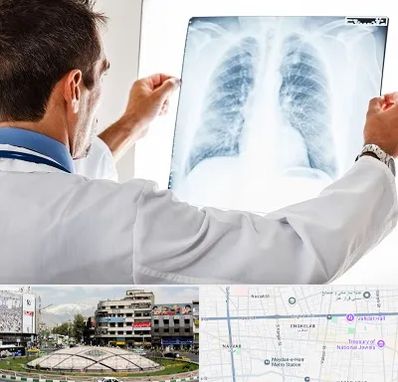 دکتر متخصص ریه در مرکز تهران