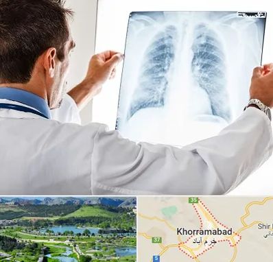دکتر متخصص ریه در خرم آباد