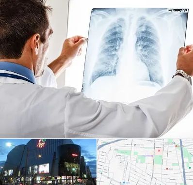 دکتر متخصص ریه در بلوار اباذر