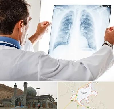 دکتر متخصص ریه در شهرضا