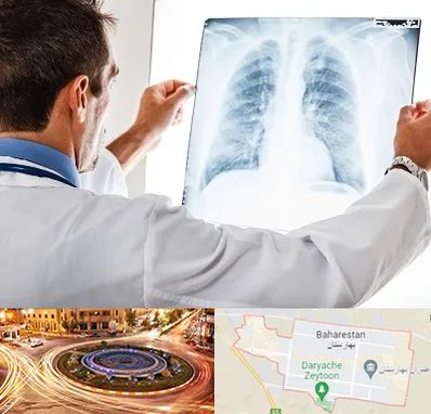 دکتر متخصص ریه در بهارستان
