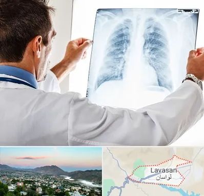 دکتر متخصص ریه در لواسان
