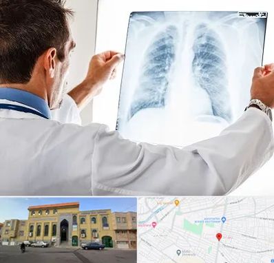 دکتر متخصص ریه در زنبیل آباد قم