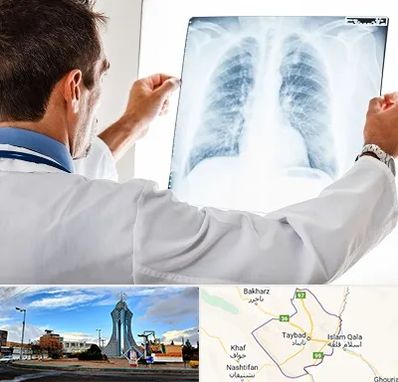 دکتر متخصص ریه در تایباد