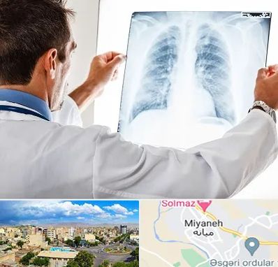 دکتر متخصص ریه در میانه