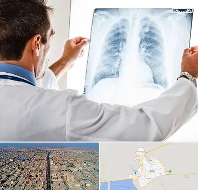 دکتر متخصص ریه در بندر ماهشهر